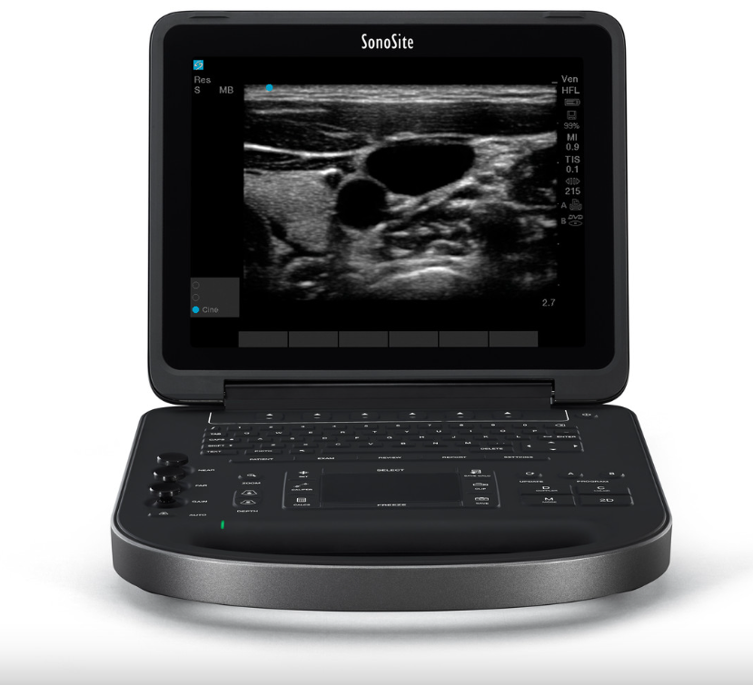 #SonoSite Edge II Ultrasound For Sale