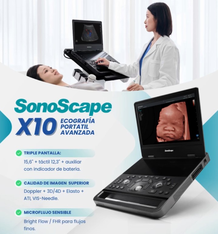 SonoScape X10 Mobile Ultrasound Echo MachineTrolley B/w Ultrasound Machine