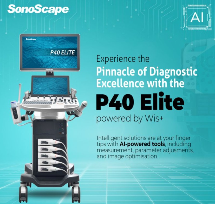 SonoScape P40 elite Trolley 3D/4D Color Doppler Ultrasound Machine| PDF