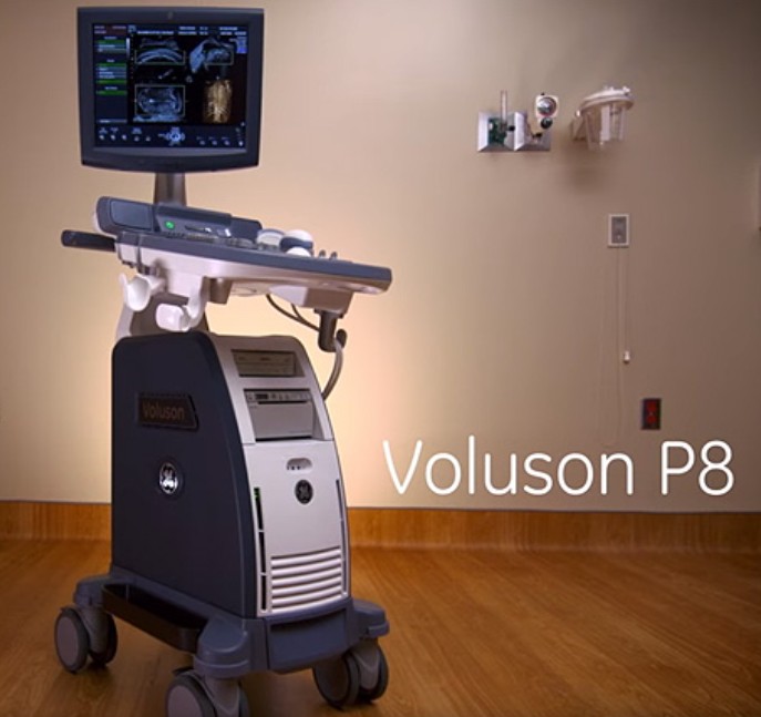 GE Voluson P8 Ultrasound and GE Voluson S8t Ultrasound | PDF
