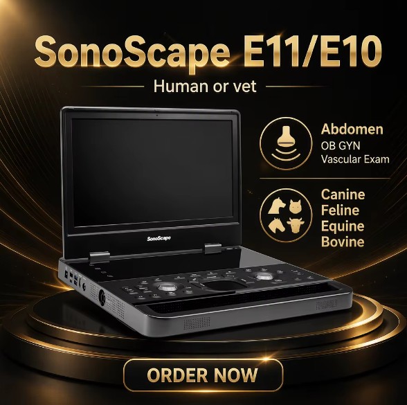 SonoScape E10/E11 Portable Ultrasound Machine Medical Ultrasound Scanner|From China