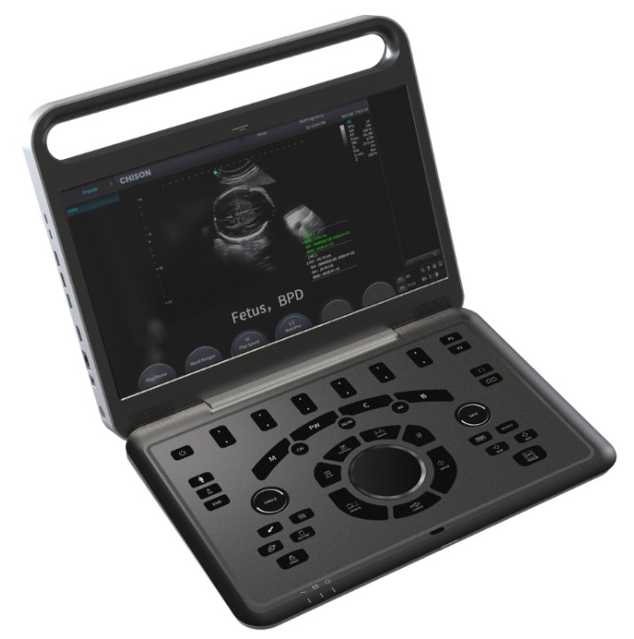 CHISON EBit 90 Portable Color Doppler Ultrasound Machine Human and Veterinary