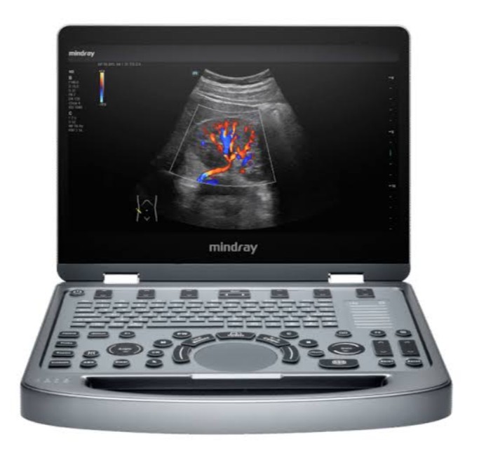 Mindray MX3 Portable Color Doppler Ultrasound System